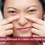 Treating Whiteheads for a Clearer and Brighter Face