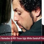 Killer Remedies to Kill Those Ugly White Dandruff Flakes