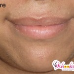 Lancome Paris Juicy Tubes Beach Plum before picture