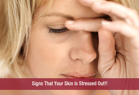 Signs That Your Skin Is Stressed Out!!