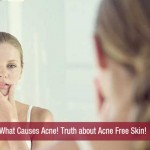 What Causes Acne! Truth about Acne Free Skin!