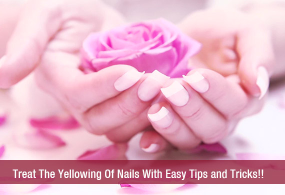 Treat The Yellowing Of Nails With Easy Tips and Tricks!!