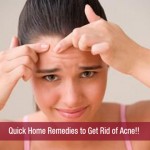 Quick Home Remedies to Get Rid of Acne!!