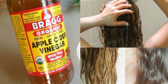 Use-apple-cider-vinegar-to-fight-dandruff