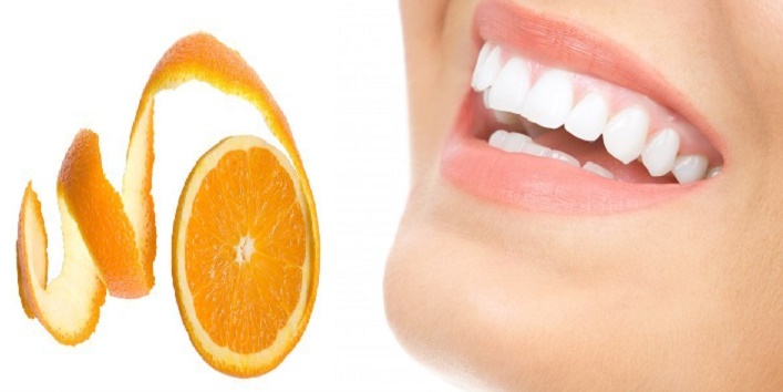 teeth5
