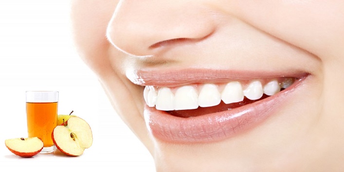 teeth54