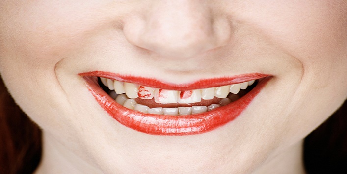 woman lipstick