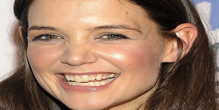 yellow teeth