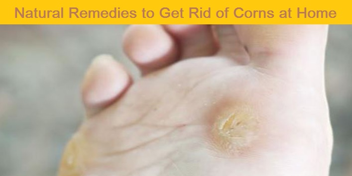 home remedies for corns