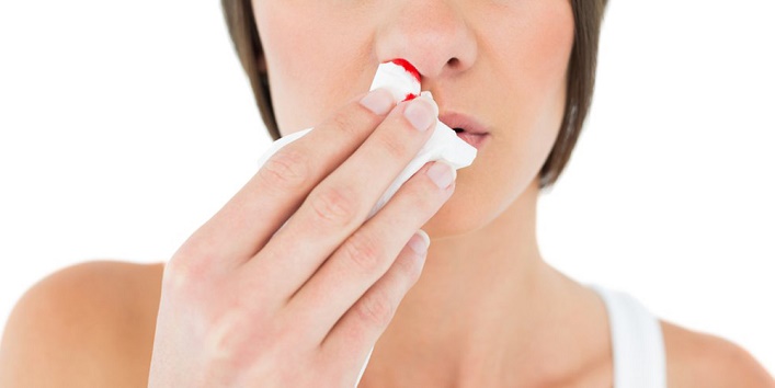 nose bleed