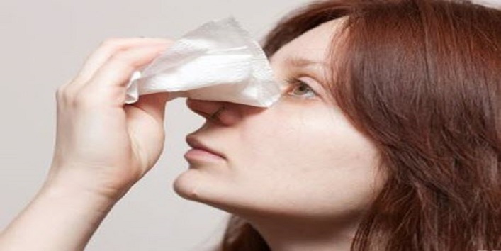 nose bleed1